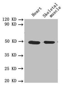 Urokinase-type plasminogen activator antibody