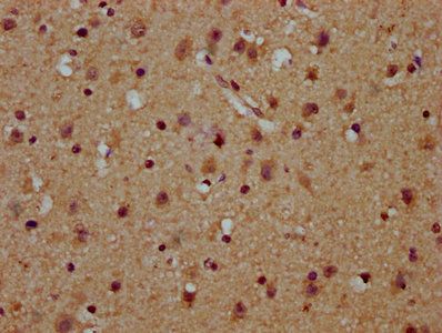 USB1 Antibody