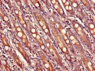 USHBP1 Antibody
