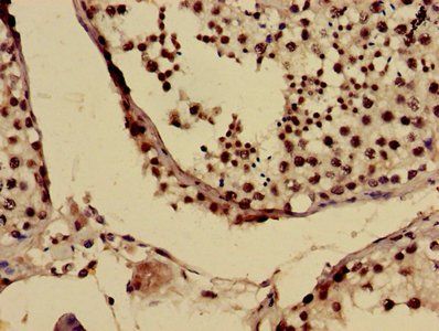 USO1 Antibody