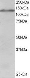 Goat anti-USP11 / UHX1 Antibody
