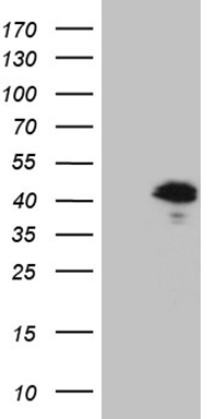 USP25 antibody