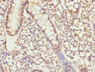 USP26 Antibody