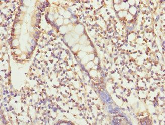 USP26 antibody