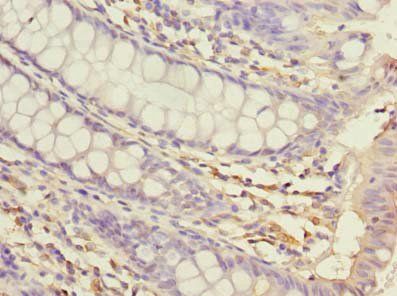 USP30 Antibody