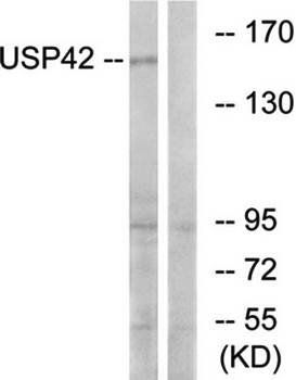 USP42 antibody