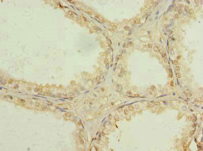 USP47 Antibody