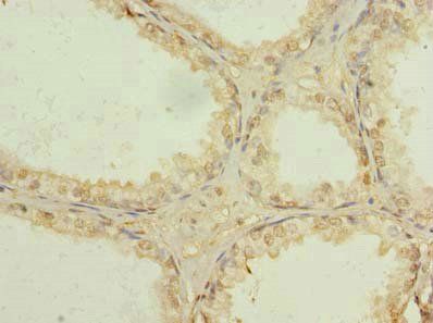 USP47 antibody