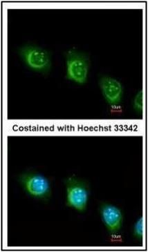 ubiquitin specific peptidase 47 Antibody