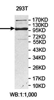 USP53 Rabbit Polyclonal Antibody