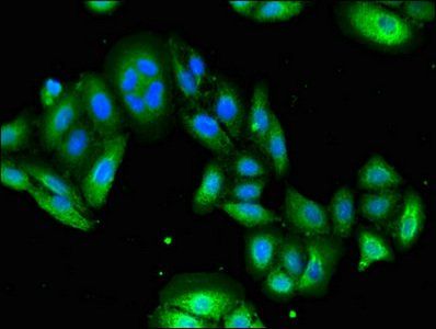 USP6 Antibody