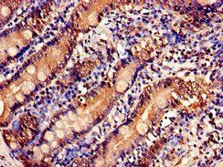 USP6NL Antibody