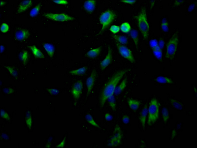 USP7 Recombinant Monoclonal Antibody