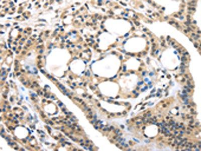 USP9X Antibody
