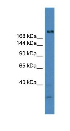 USP9Y antibody