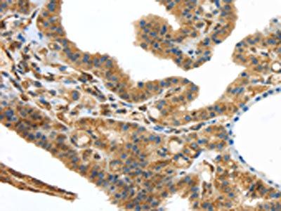 UTS2B Antibody