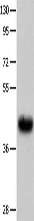 UTS2R Antibody