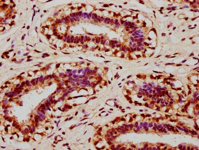 UVSSA Antibody