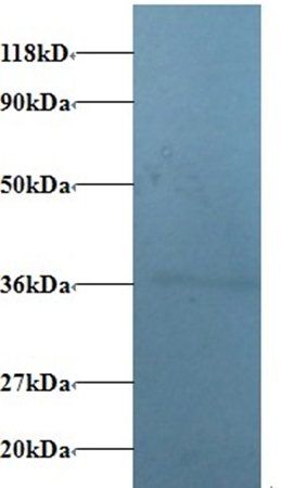 ATP6V1E1 Antibody