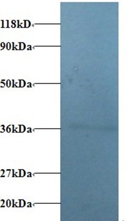 V-type proton ATPase subunit E 1 antibody