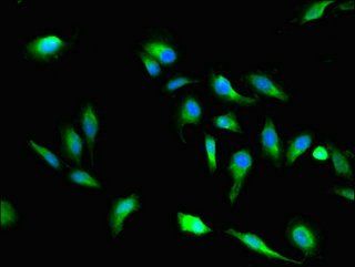 VAC14 Antibody