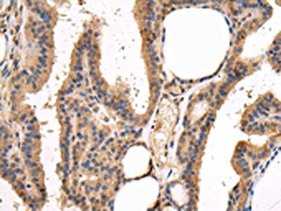 VAMP5 Antibody