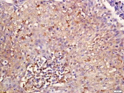 VAMP8 Rabbit Polyclonal Antibody