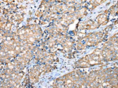 VAPA Antibody