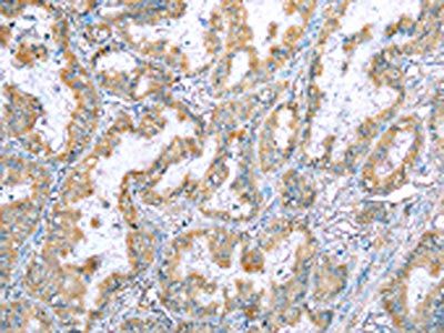 VAPA Antibody