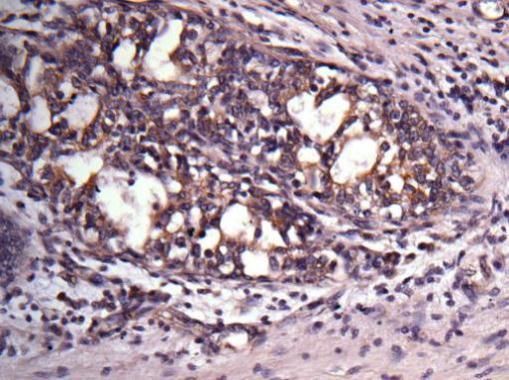 VAPA antibody [N1N3]