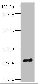 VAPB antibody