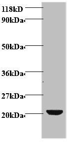 Vascular endothelial growth factor C antibody