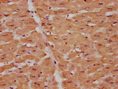 Vascular endothelial growth factor D antibody