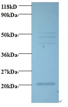 Vascular endothelial growth factor C antibody (Biotin)