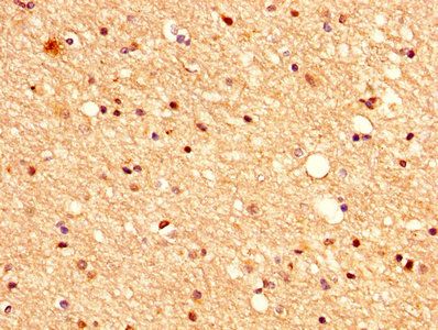VASH1 Antibody