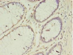 VASH2 Antibody