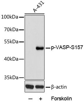 VASP (Phospho-S157) antibody
