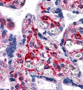 VCAM1 Antibody