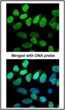 VCP antibody