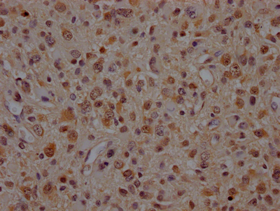 VCP Recombinant Monoclonal Antibody