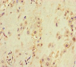 VDAC2 Antibody