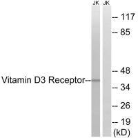 VDR (Ab-51) antibody
