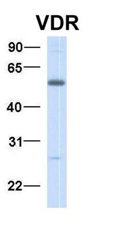 VDR antibody