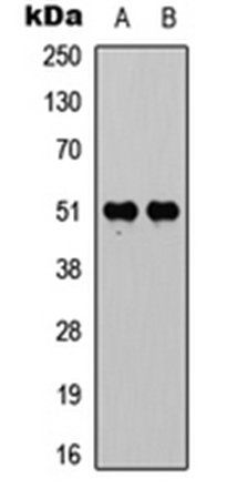 Vitamin D3 Receptor (phospho-S208) antibody
