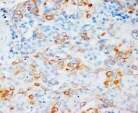 Anti-VEGF/VEGFA Antibody