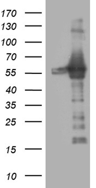 VEGF Receptor 1 (FLT1) antibody