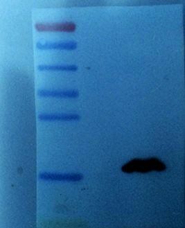 VEGF165 antibody