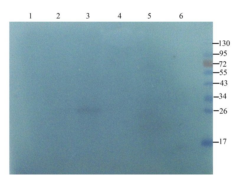 VEGF antibody