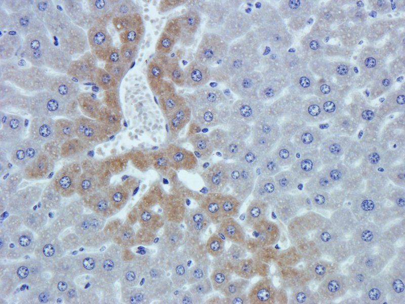 VEGF antibody