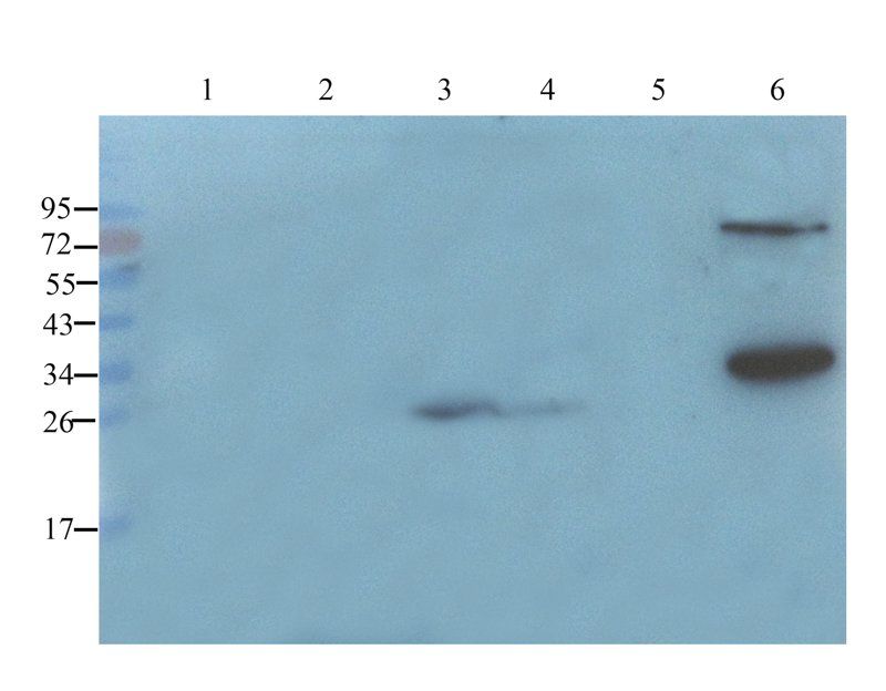 VEGF Rabbit Polyclonal Antibody